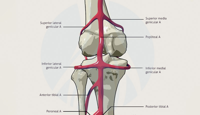 MARCELO-KALIL-Aneurisma-de-artéria-poplítea-INTERNA