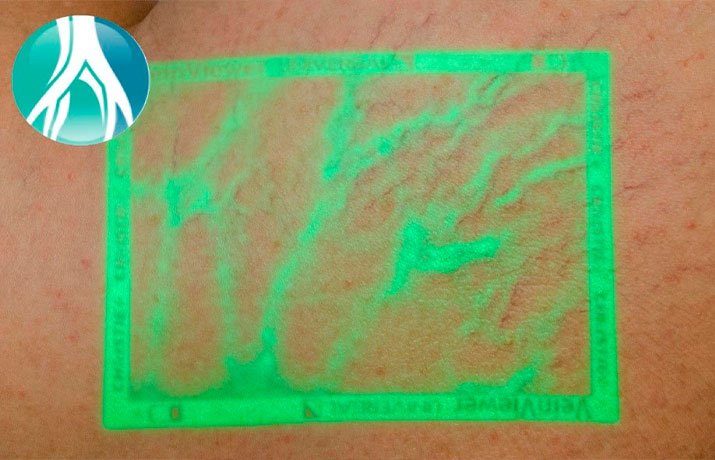 imagem-tecnicas-combinadas-2