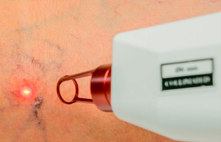 imagem-tecnicas-combinadas-3