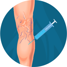 imagem thumb angioplastia marcelo kalil