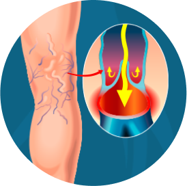 imagem thumb angioplastia marcelo kalil