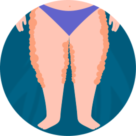 imagem thumb angioplastia marcelo kalil