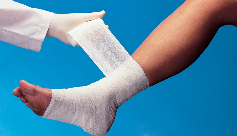 MARCELO-KALIL-ÚLCERAS-VENOSAS-INTERNAOFICIAL MARCELO-KALIL-ÚLCERAS-VENOSAS-INTERNA